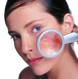 El blanqueamiento de la piel en la cosmetología